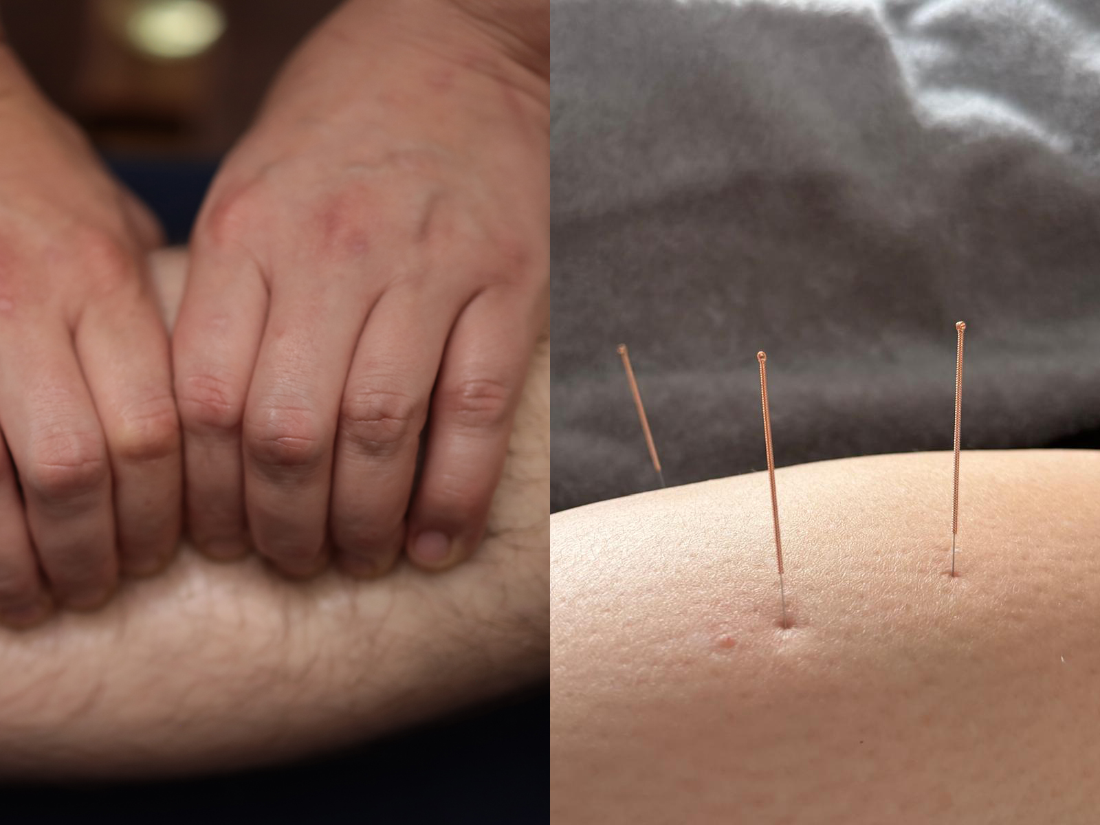 Massage and dry needling